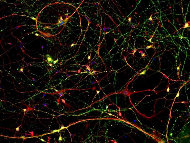 Neurons in petri dish
