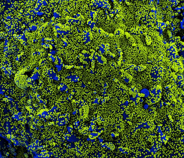Cell surrounded by viral particles