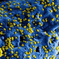 Blue dots show MERS-CoV particles on the surface of a cell