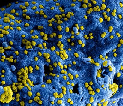 Blue dots show MERS-CoV particles on the surface of a cell