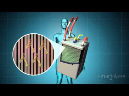 Diagram of artificial kidney device highlights filter design.