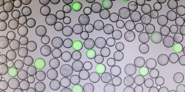 A digital PCR detection of HIV-infected cells (in green), in the Adam Abate Lab, in Byers Hall, at the Mission Bay campus.