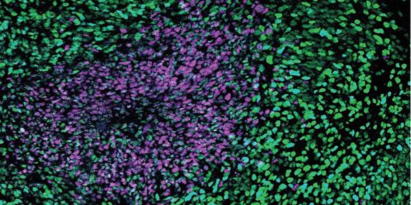 organoid